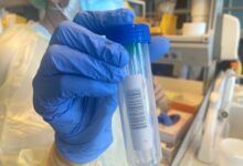 Científicos estudian dos posibles casos de Omicron en Canarias-Noticias de Tenerife-Web Oficial