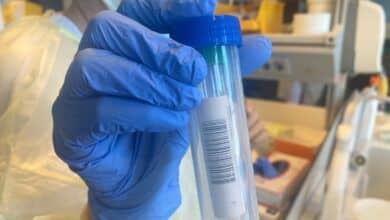 Científicos estudian dos posibles casos de Omicron en Canarias-Noticias de Tenerife-Web Oficial