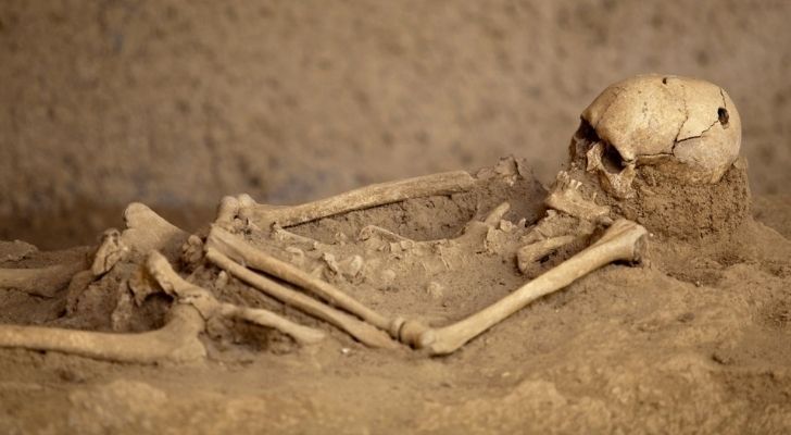 Esqueleto humano con un agujero perforado en el cráneo