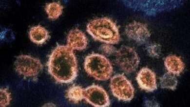 This 2020 electron microscope image provided by the National Institute of Allergy and Infectious Diseases - Rocky Mountain Laboratories shows SARS-CoV-2 virus particles which cause COVID-19, isolated from a patient in the U.S., emerging from the surface of cells cultured in a lab. (Photo: AP/File)