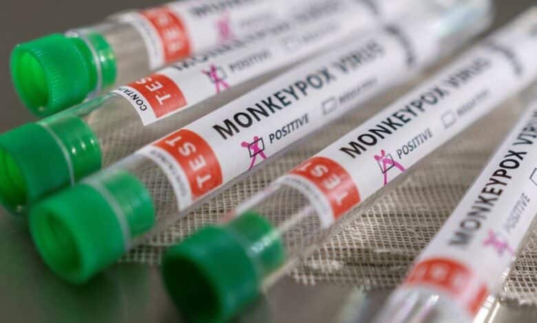 Inglaterra descubre 36 nuevos casos de viruela del simio, el total aumenta a 56
