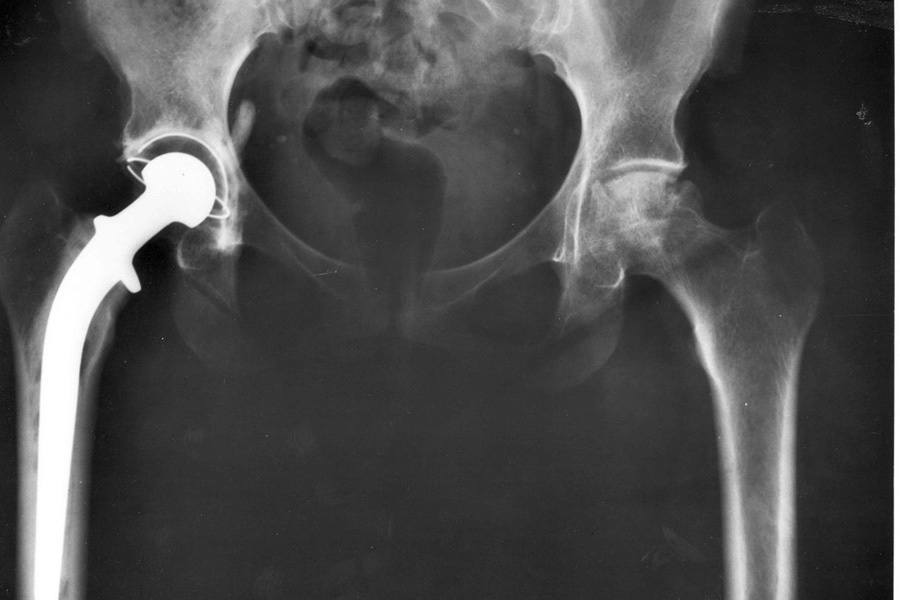 Descubrimientos científicos 2015 Huesos 3D