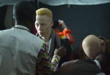 El concurso de belleza Albino amplía la definición de belleza