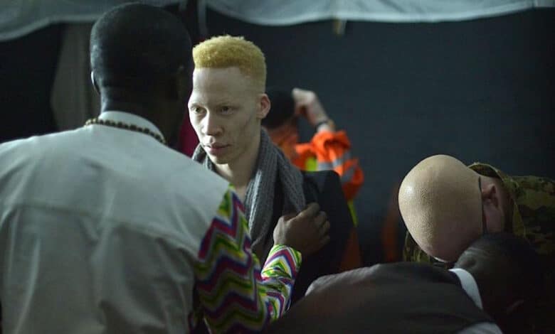 El concurso de belleza Albino amplía la definición de belleza