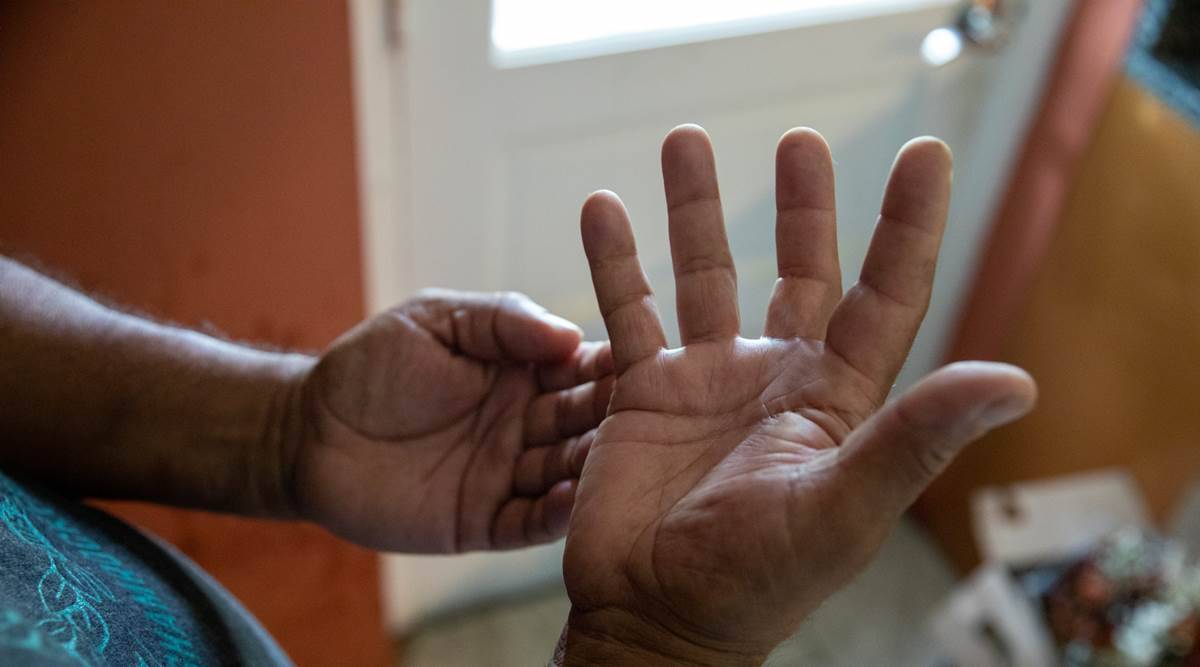 Moises Ferrera muestra su mano derecha que ha perdido movilidad después de que traficantes de migrantes la golpearan repetidamente con un martillo en un intento de extorsionar a su familia, en Maryland, (Amanda Andrade-Rhoades/The New York Times)