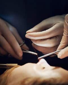 Rinoplastia - Todo lo que necesita saber 3 procedimiento de rinoplastia con herramientas