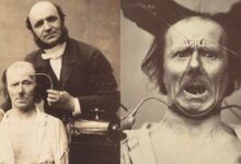 Fotos de los experimentos de Duchenne de Boulogne sobre el rostro humano