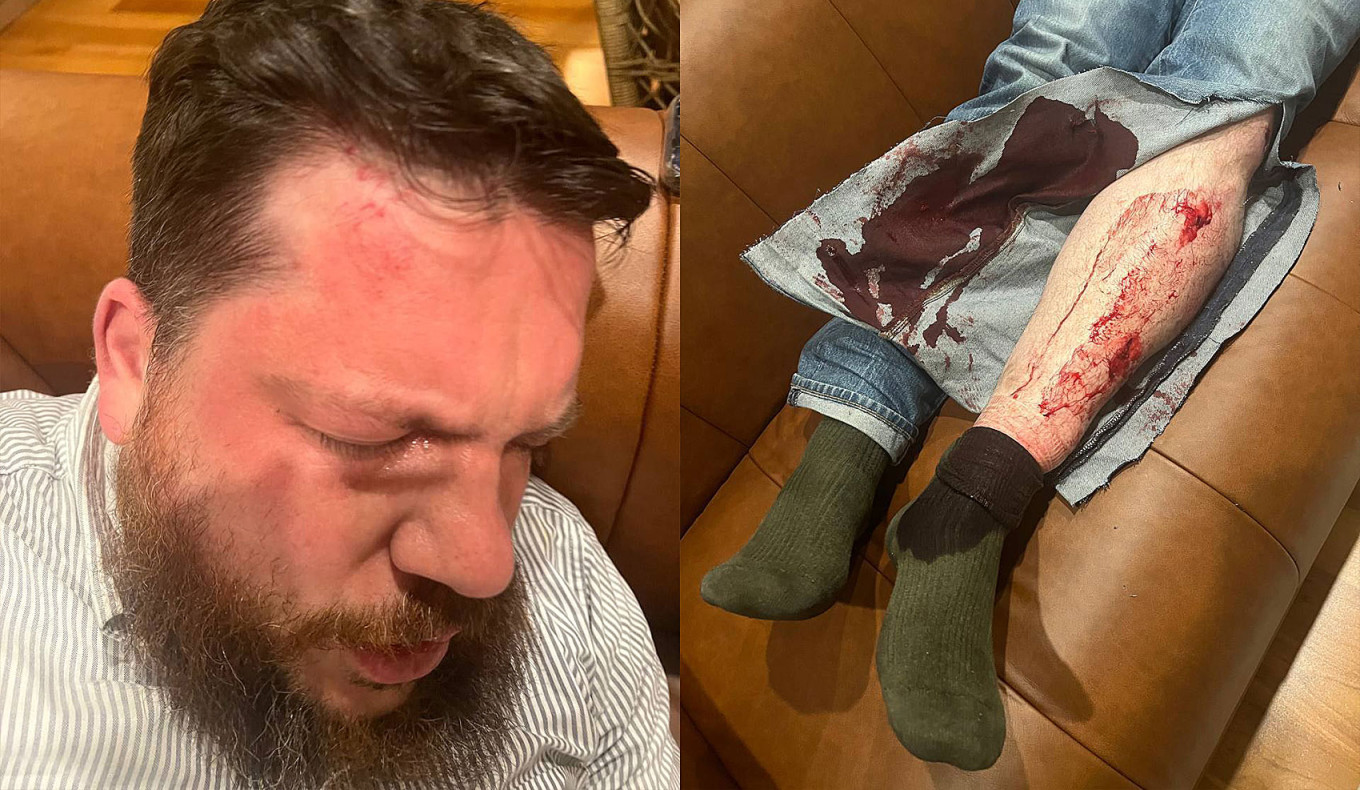 
					
					
					
					Leonid Volkov resultó herido tras ser atacado frente a su casa en Vilna.Ivan Zhdanov/El Telégrafo				