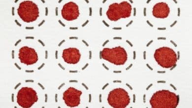 Three rows of four dried blood spot tests on white fiber filter. The top and bottom rows are slightly cut off by the image dimensions. In each test, a red spot of blood can be seen in inside a circle drawn using dashed black lines.