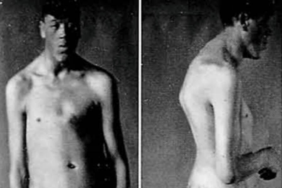 Adam Rayner, el hombre que pasó de enano a gigante 4 Investigación de Oscar Hirsch